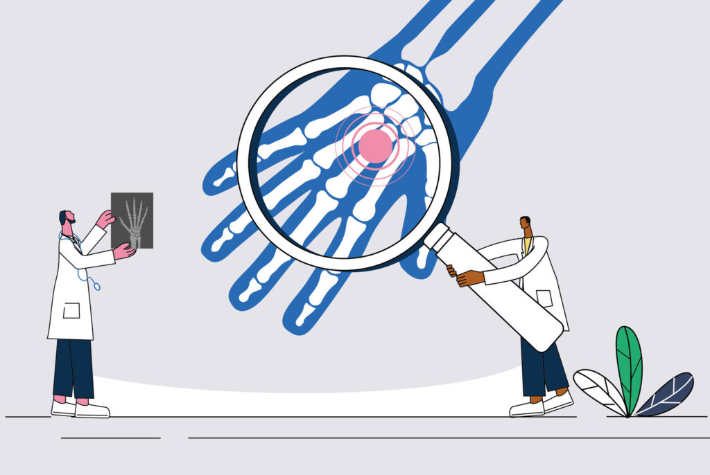 two doctors examine degenerative joint issue from x-ray