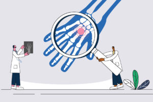 two doctors examine degenerative joint issue from x-ray